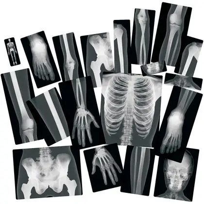 Set de 18 laminas de rayos x